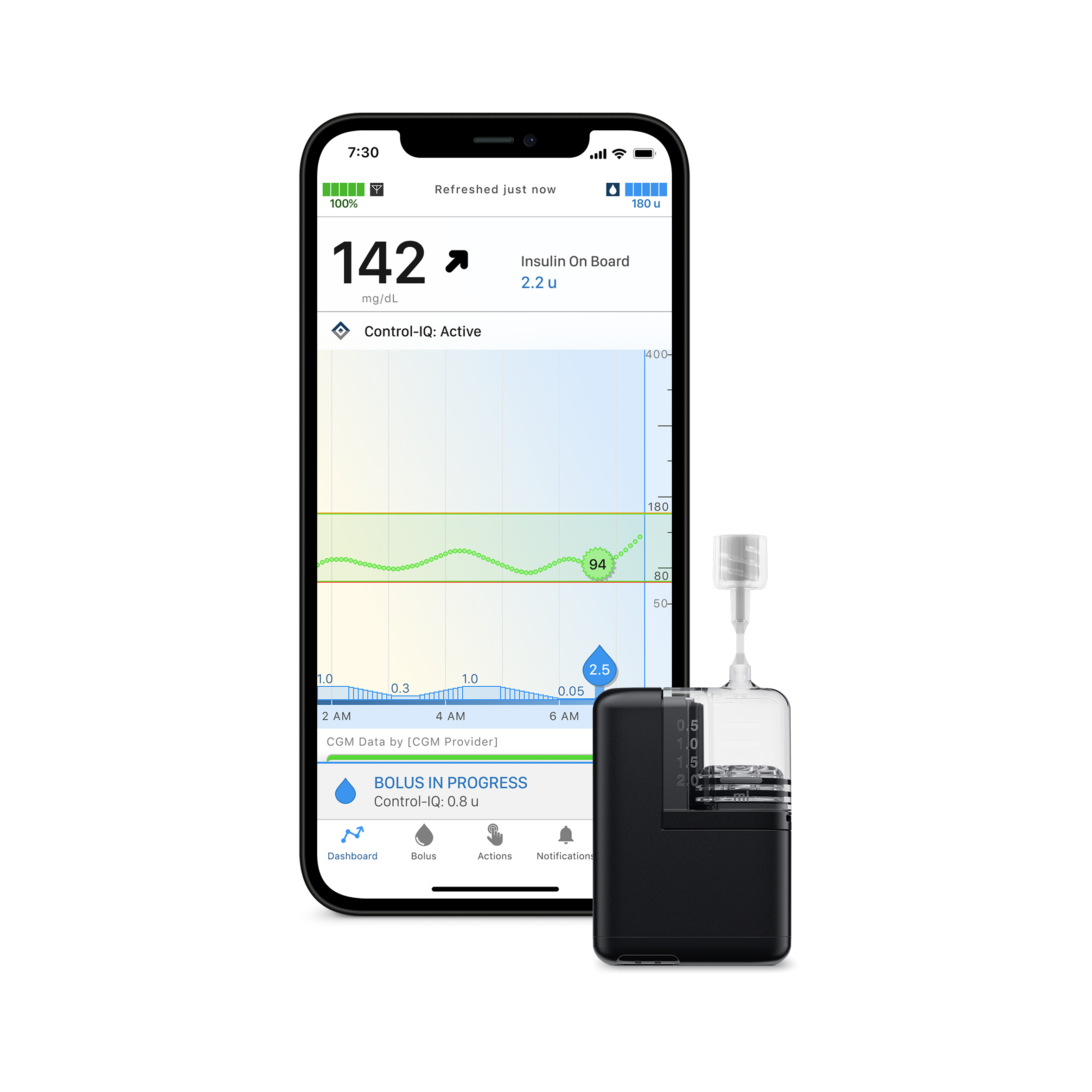 Tandem Mobi pump with iPhone displaying mobile app