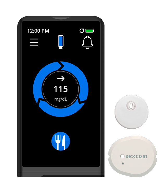 Continuous glucose monitor displaying 115 mg/dL, with Dexcom sensor and transmitter.