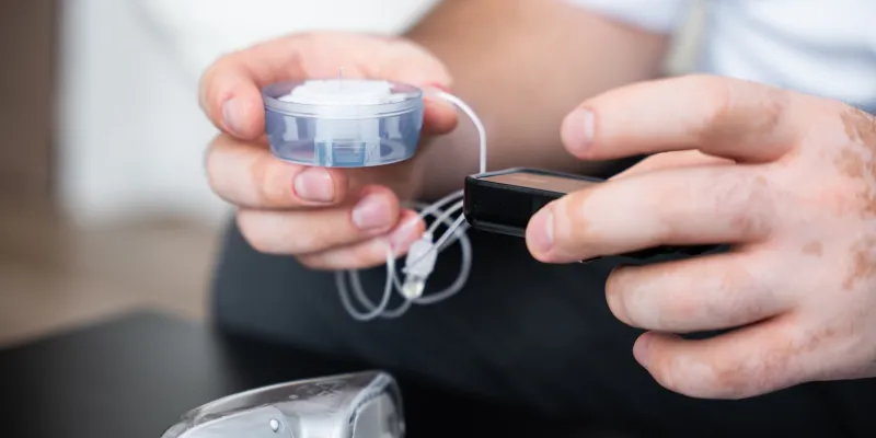 Man holding an infusion set for delivering insulin from an insulin pump